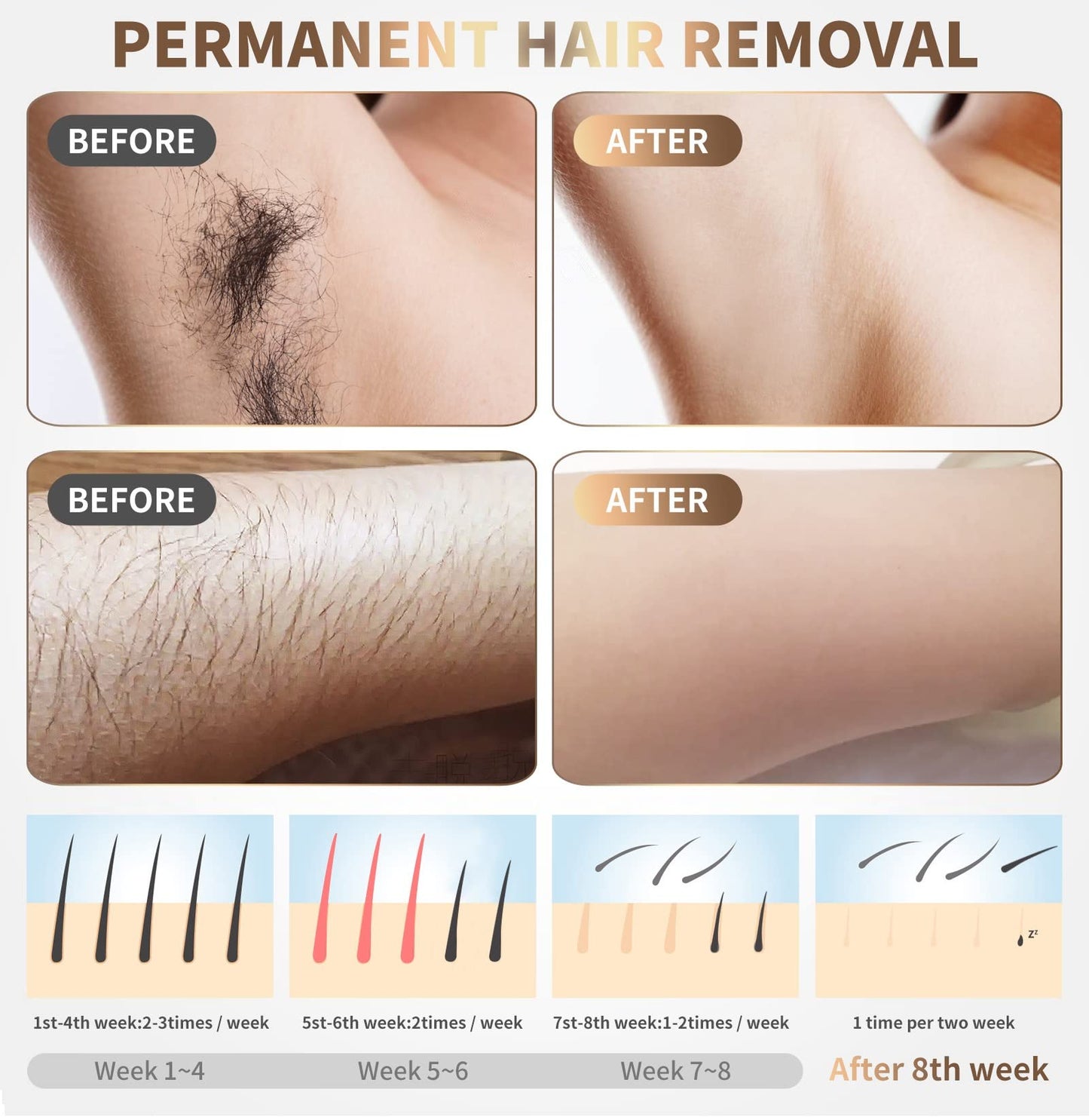 Hair Removal Device for Women and Man (S)